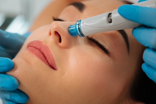 Microneedling Services picture